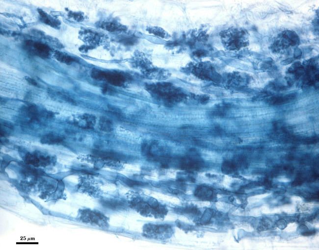 Staining of Mycorrhizal Roots