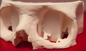 Mcor-3D-Printing-Belgium-Surgery